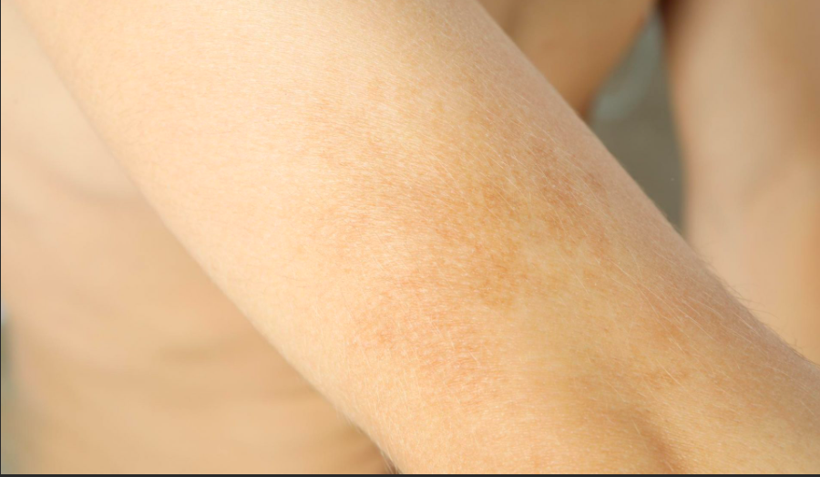 Bir gecede ortaya çıkıyor ölümcül olabiliyor! Şeytan kınası neyin habercisi? - Resim: 4