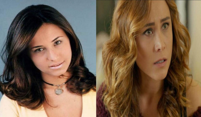 Filiz Akın'ın estetiksiz haline bakın çok şaşıracaksınız! - Resim: 3