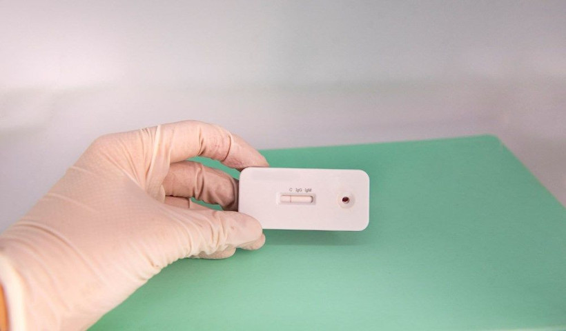 Koronavirüs hastalarının sadece yüzde 10’u antikor geliştiriyor - Resim: 1