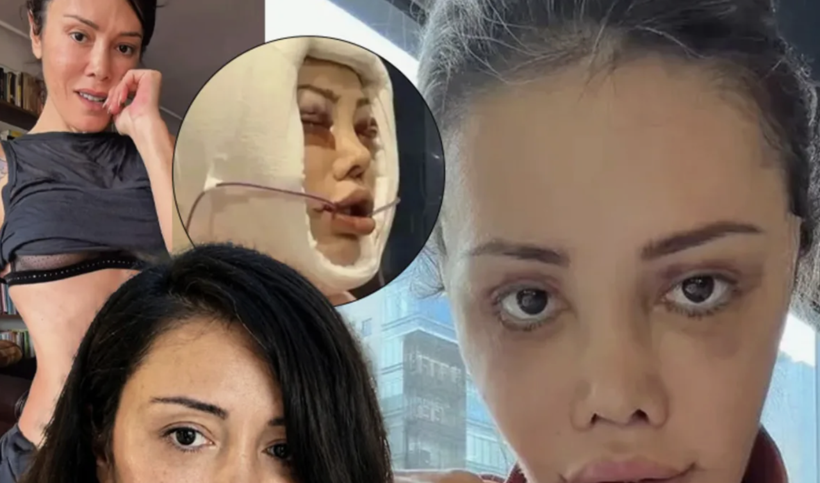 Didem Ceran yeniden ameliyat masasına yatacak! - Resim: 1