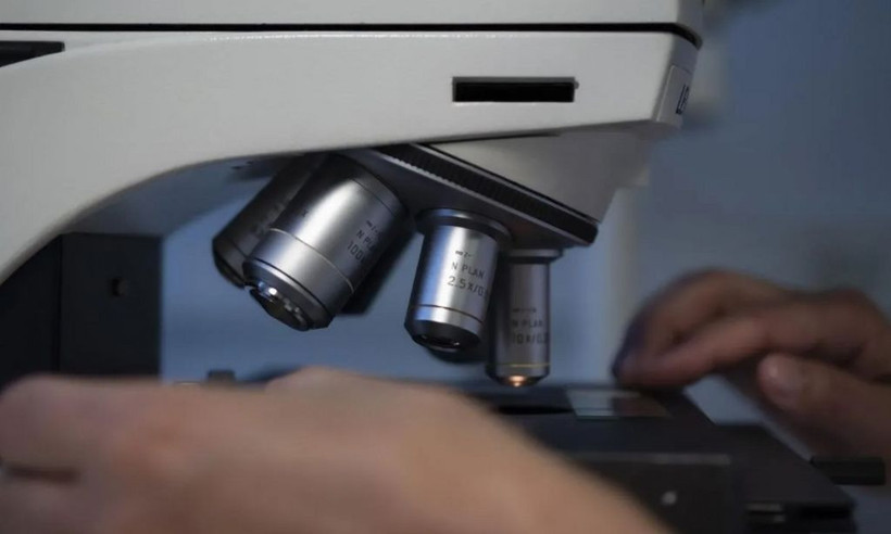 Yeni kabus Langya/LayV virüsünün belirtileri belli oldu - Resim: 3