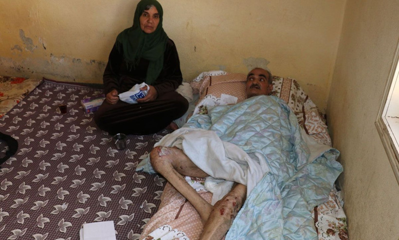 Vücudunu ve ağzının içini saran yaralar kabusu oldu! Suriyeli adamın yürek yakan feryadı - Resim: 4