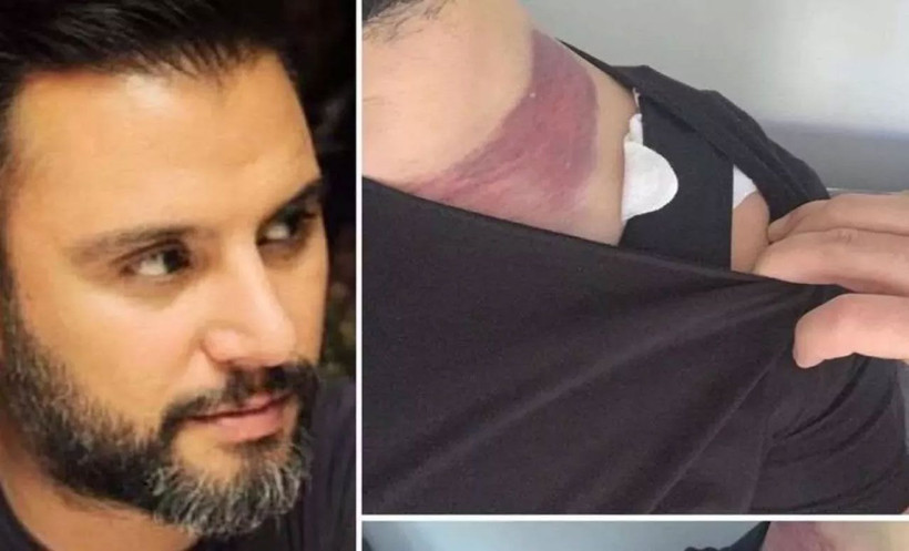 Ölümden dönen Alişan soluğu mahkemede aldı! Eşiyle davalık oldular - Resim: 4