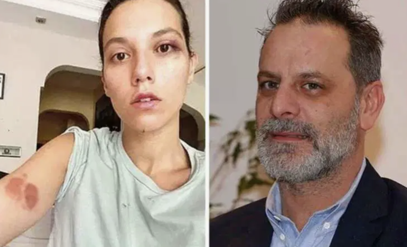 Ozan Güven sonunda patladı! Ceza aldığı şiddet davası hakkında bakın neler söyledi - Resim: 7