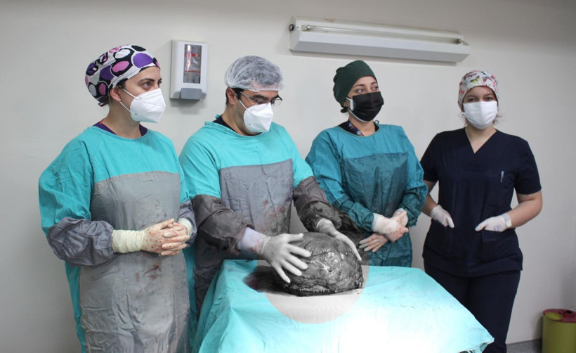 Eskişehir'de 9 kiloluk kitle şaşırttı! Hastaneye gaz şikayetiyle gitmişti - Resim: 2