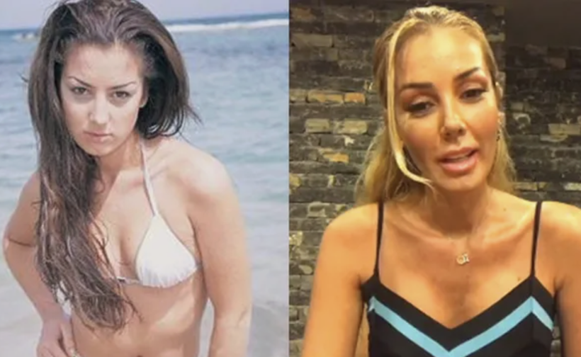 Estetik onlar için mucize oldu! Estetikle adeta yeniden doğan ünlüler... - Resim: 2