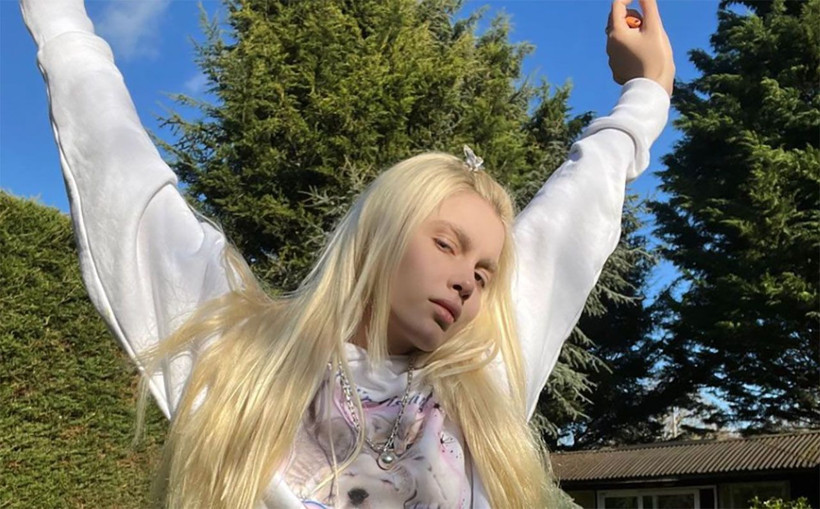 Aleyna Tilki'nin beti benzi attı hastanelik oldu! "İyileşince konuşuruz" - Resim: 2