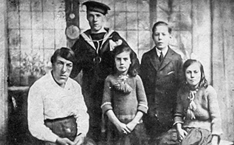 Yakalandığı hastalık sonrası bir anda dünyanın en çirkin kadını oldu - Resim: 3