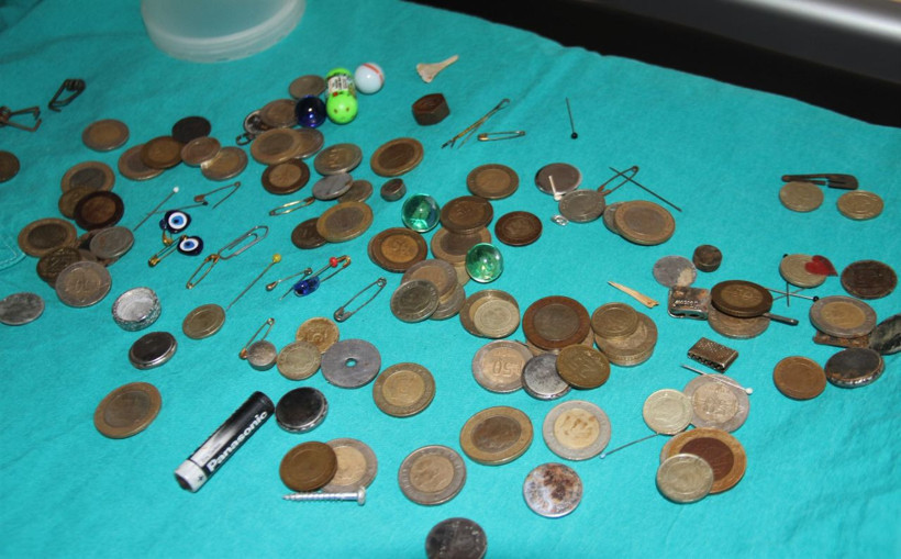 Midelerden çıkanlar şok etti! Ne ararsan var para, iğne, boncuk, pil, yüzük... - Resim: 4