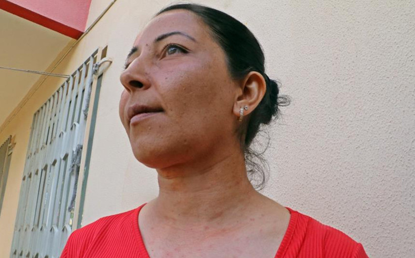 Antalya'da evinin bahçesindeki tırtılları süpüren kadın hastanelik oldu: Yüzüm alev topu gibi oldu