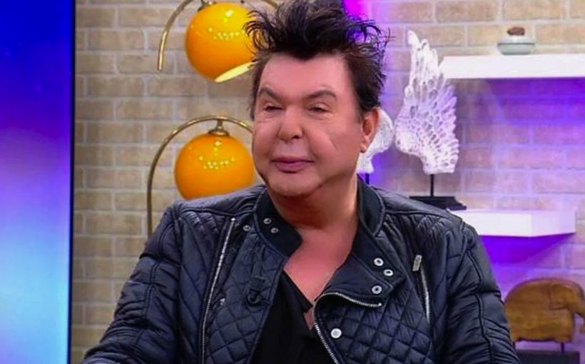 Kuşum Aydın yüzüne yaptırdığı tüm dolgulardan kurtuldu, ameliyat oldu! Son hali olay... - Resim: 3