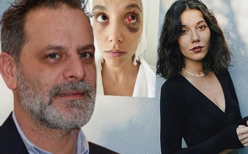 Ozan Güven sonunda patladı! Ceza aldığı şiddet davası hakkında bakın neler söyledi