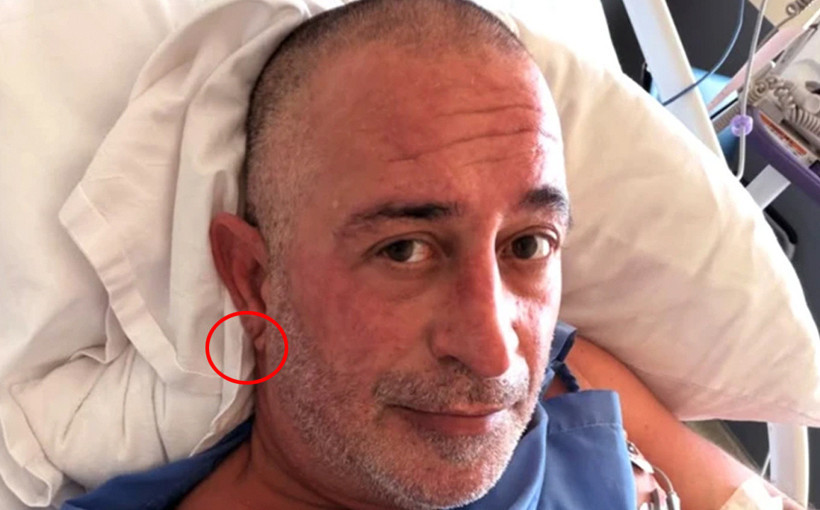 Cem Yılmaz kalp krizi geçirdi! Herkes kulak memesindeki o detayı konuşuyor