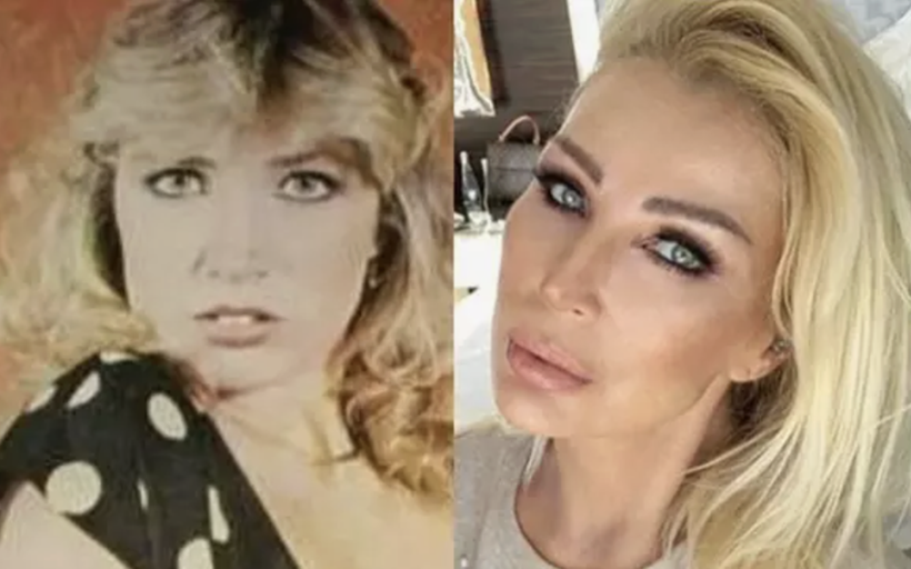 Estetik onlar için mucize oldu! Estetikle adeta yeniden doğan ünlüler... - Resim: 3