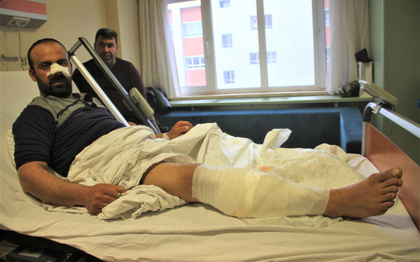 Korkunç olay: Burnunu ve bacağını parçaladılar! - Resim: 1