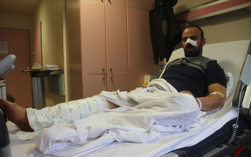 Korkunç olay: Burnunu ve bacağını parçaladılar! - Resim: 2