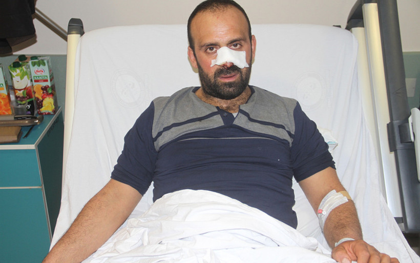 Korkunç olay: Burnunu ve bacağını parçaladılar! - Resim: 3