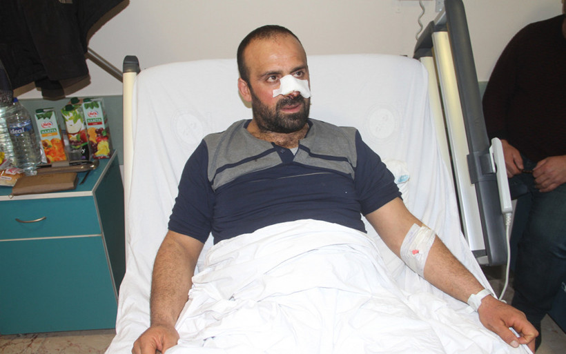 Korkunç olay: Burnunu ve bacağını parçaladılar! - Resim: 4