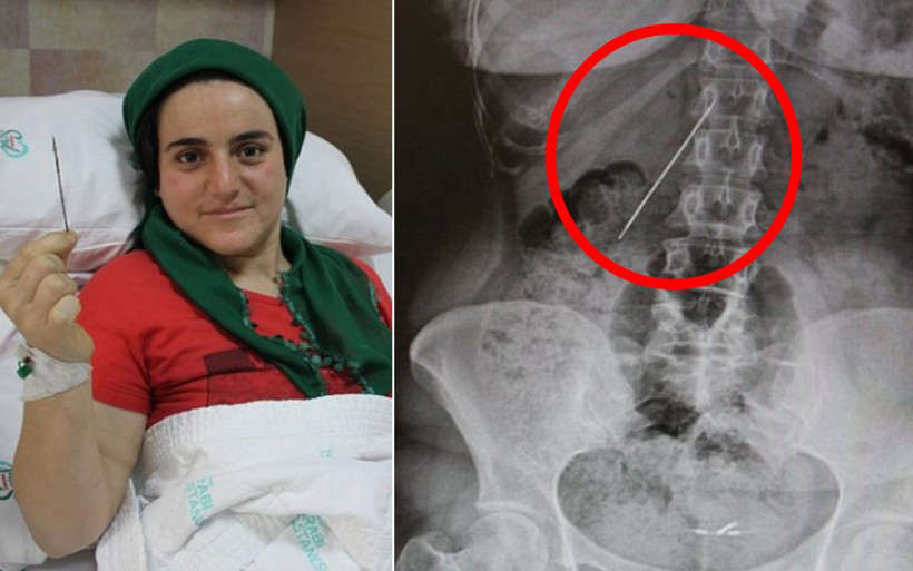 Kahreden gerçeği 15 yaşında öğrendi! 26 yıl sonra hayata yeniden döndü - Resim: 1