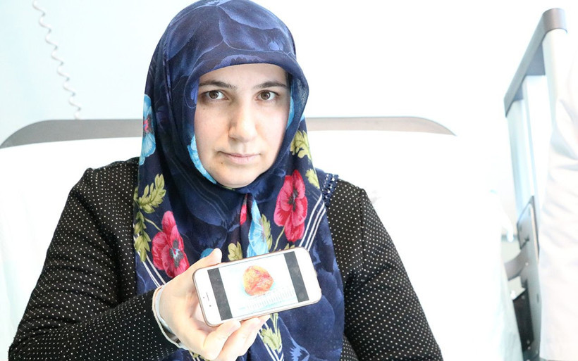 Kalbinden 6 santimetre çapında kitle çıkarıldı - Resim: 2