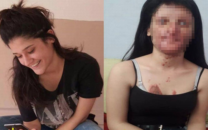 Hatay'da nişanlısının saldırdığı Berfin için kampanya - Resim: 4