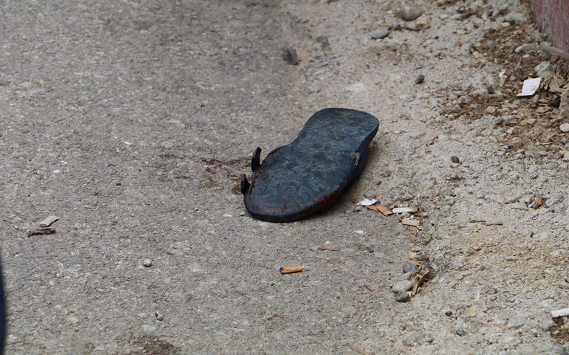 Antalya’da koca dehşeti Eşini ağır yaraladı - Resim: 3