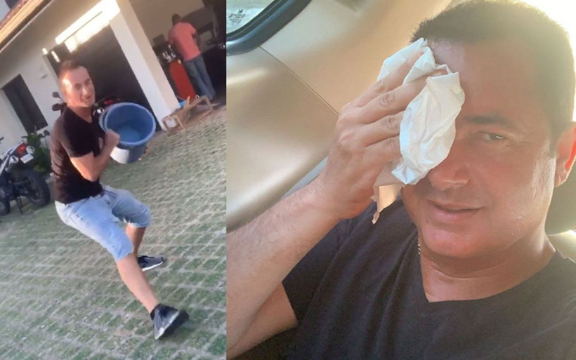 Acun Ilıcalı talihsiz kaza geçirdi son halini sosyal medyadan paylaştı - Resim: 2