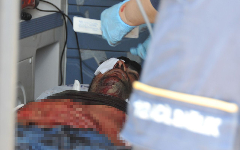 Antalya'da baba ile oğlu arasındaki tartışma hastanede bitti - Resim: 2