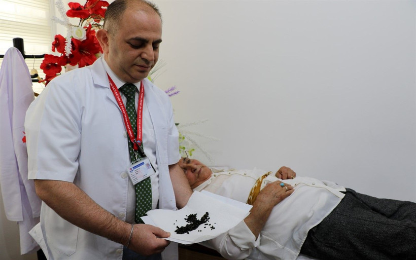 Yaşlı kadının safra kesesinden 450 tane taş çıktı - Resim: 3