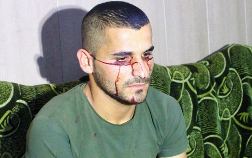 Iraklı genç kan ağlıyor! Hastalığına çare bulunamadı Türkiye'den yardım istedi - Resim: 1