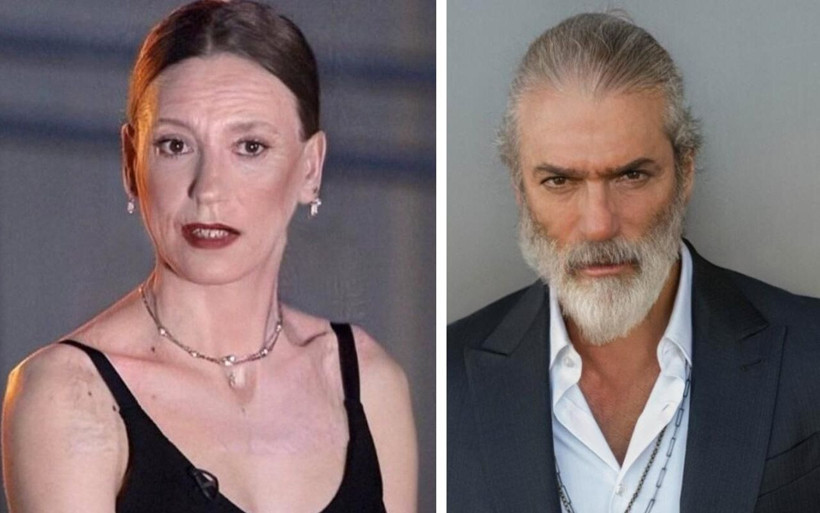 Yaşlandırma akımına uydular! Ünlülerin bu halini görenler gözlerine inanamadı - Resim: 1