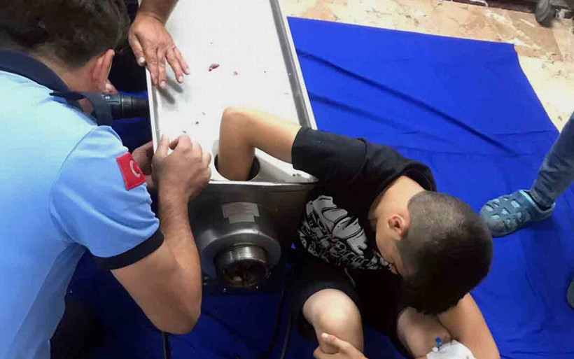Gaziantep'te bir çocuk elini kıyma makinesine kaptırdı - Resim: 2