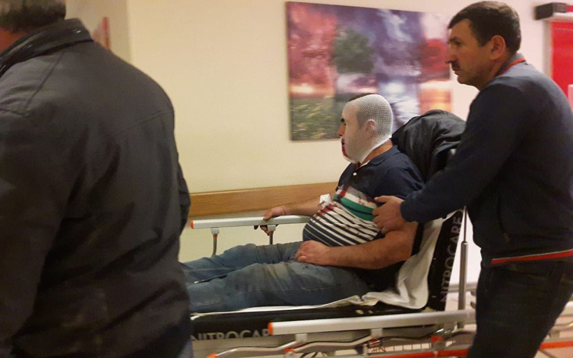 Bursa'da vincin kancası yüzüne çarpan işçi ağır yaralandı - Resim: 1