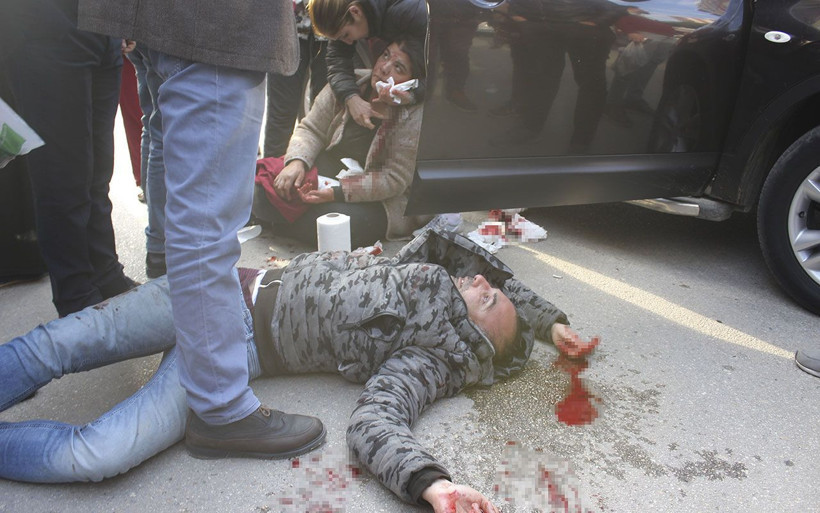 Adana'da bir şahıs yanında oturan kadını ağzından bıçakladı - Resim: 2
