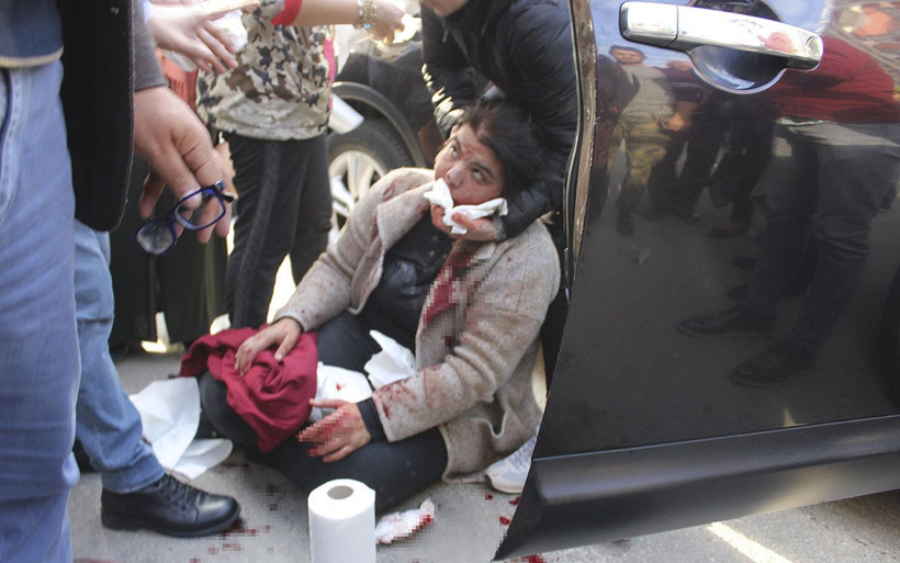 Adana'da bir şahıs yanında oturan kadını ağzından bıçakladı - Resim: 3