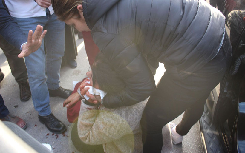 Adana'da bir şahıs yanında oturan kadını ağzından bıçakladı - Resim: 4