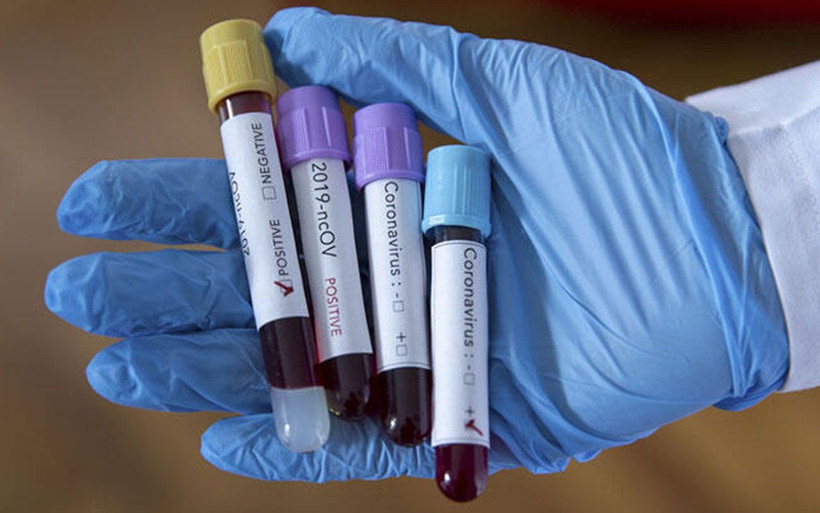 Yarasalar neden ölümcül virüs taşıyor? İşte Koronavirüs gerçekleri - Resim: 1