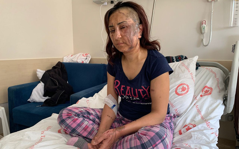 Isparta'da boşanmak isteyen eşe kezzaplı saldırı - Resim: 1