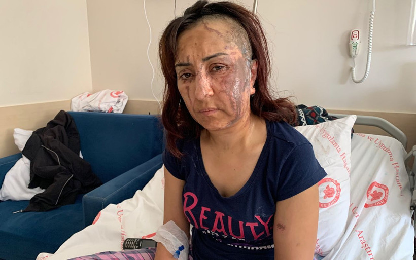 Isparta'da boşanmak isteyen eşe kezzaplı saldırı - Resim: 2