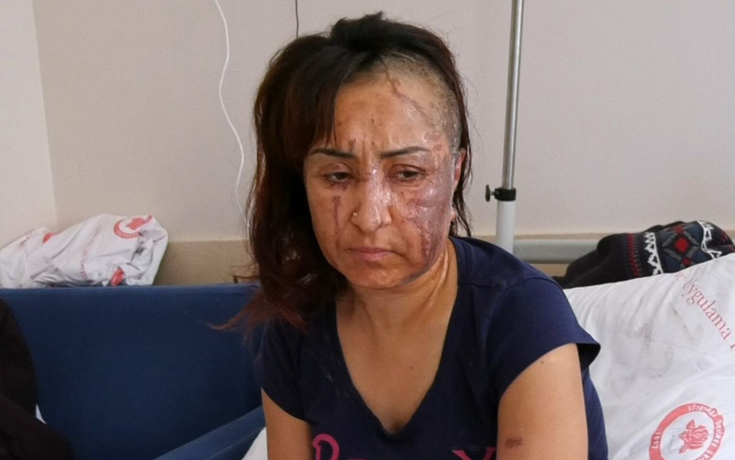 Isparta'da boşanmak isteyen eşe kezzaplı saldırı - Resim: 3