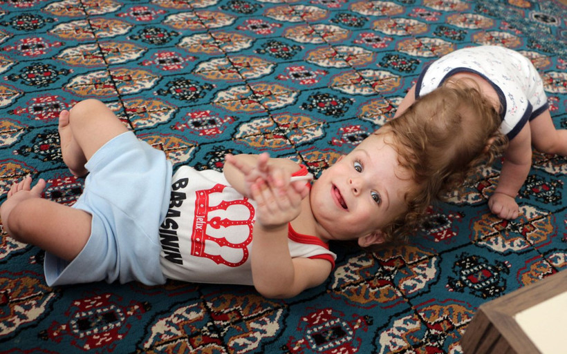 Antalya'da doğan yapışık ikizler İngiltere'de ayrıldı! Cumhurbaşkanı göndermişti - Resim: 4