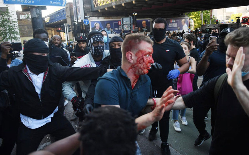 İngiltere siyahi protestocuyu konuşuyor! Darp edilen aşırı sağcıyı kurtardı - Resim: 2