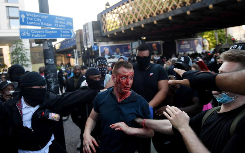 İngiltere siyahi protestocuyu konuşuyor! Darp edilen aşırı sağcıyı kurtardı - Resim: 4