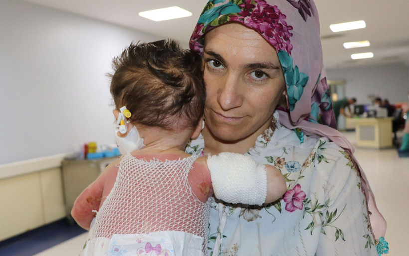 Van'da süt kazanına düşen Nurullah bebekten iyi haber geldi! - Resim: 2