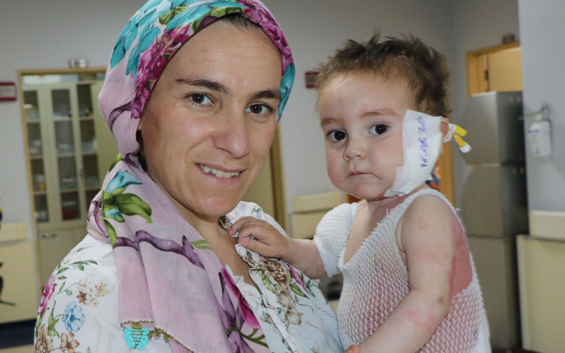 Van'da süt kazanına düşen Nurullah bebekten iyi haber geldi! - Resim: 3