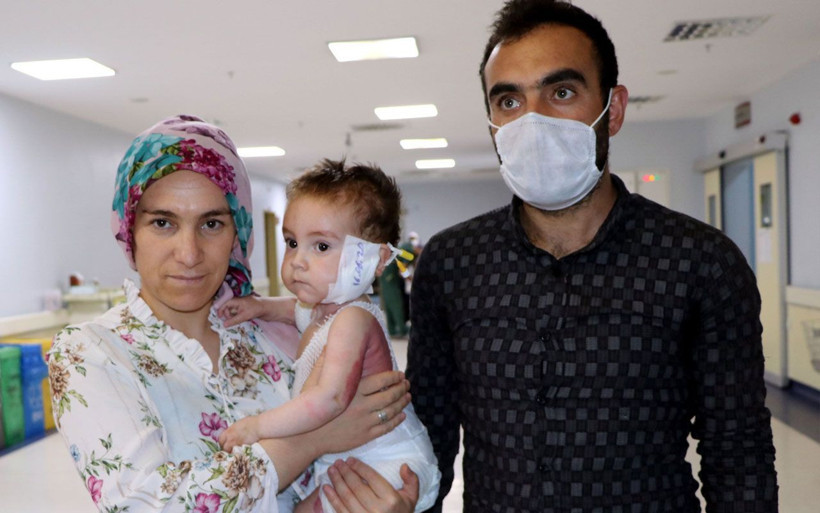 Van'da süt kazanına düşen Nurullah bebekten iyi haber geldi! - Resim: 4