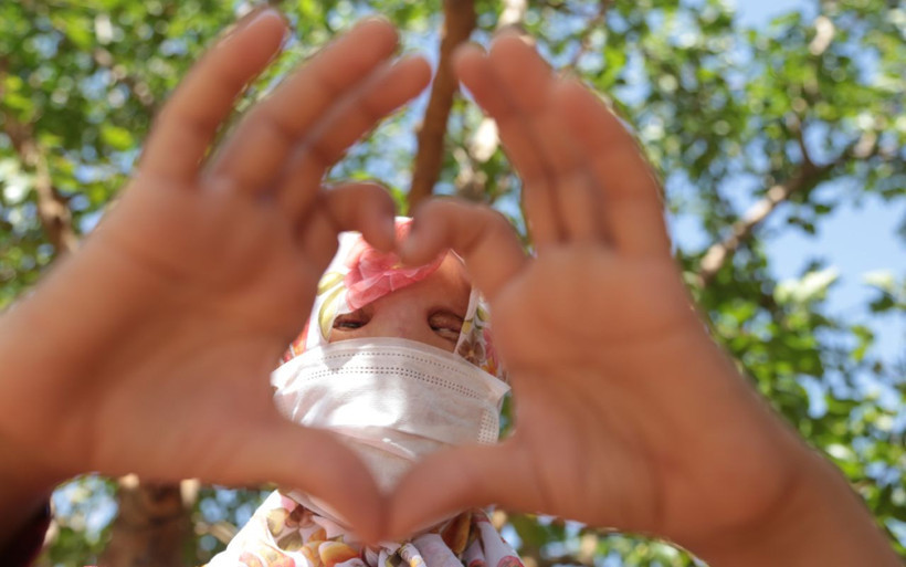Kahramanmaraş'ta Leyla doku nakliyle hayata tutundu bebekken yanmıştı - Resim: 1