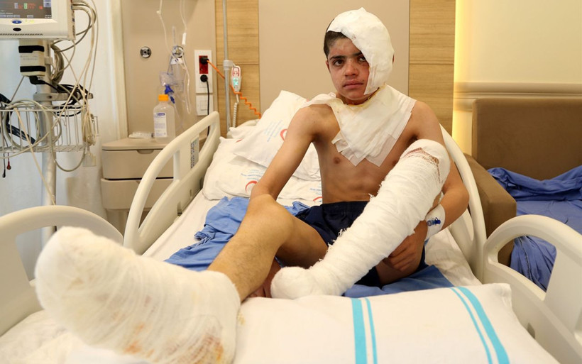 Kars'ta yüksek gerilim hattına kafasıyla temas etti feci şekilde yaralandı - Resim: 1