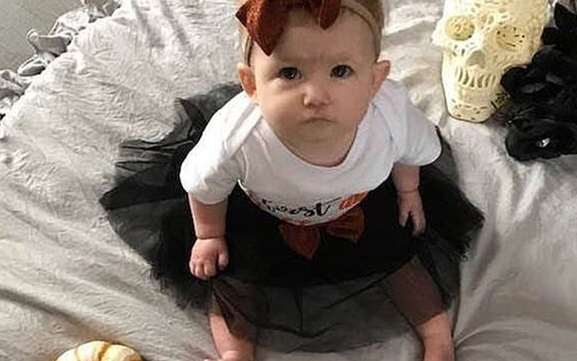 ABD'de kan donduran olay! İki pitbull 17 aylık bebeği öldürdü - Resim: 2