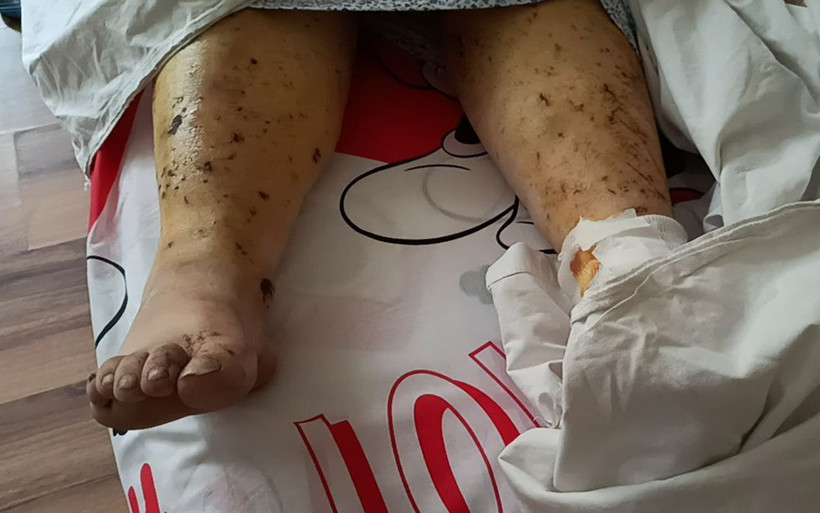 Sakarya'da havai fişek fabrikasındaki patlamadan yaralı kurtulan işçi: 30 metre fırladım - Resim: 2